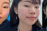 低估了599元的抗衰项目,提拉紧致效果真好