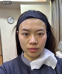 做医美要选能力范围内最好的,抗衰我推荐热玛吉!效果真心好