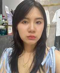 你选热玛吉还是超声炮?这是我做超声炮后的变化