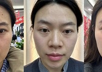 做医美要选能力范围内最好的,抗衰我推荐热玛吉
