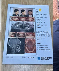 6-12岁孩子牙不齐,别拖!49.9做全项检查