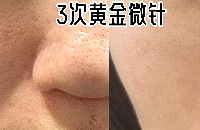 ƽ𳬹꿨999 꿨1980