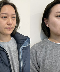 这个方法真的能让肤色立马提亮3倍,关键肤质也提升了一个档次
