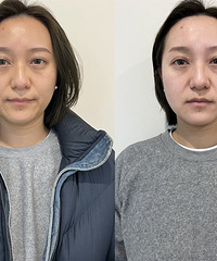这个方法真的能让肤色立马提亮3倍,关键肤质也提升了一个档次