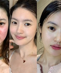10年敏感肌,4个月就恢复好了