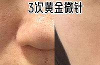 ƽ΢880 ƽ𳬹꿨999 꿨1980