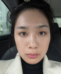 这个方法对付泪沟凹陷,真的太有效了!看起来年轻好几岁