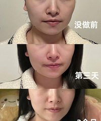 32ײⳬڣָ2ºҸоԼ5