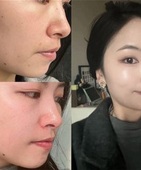 32���ײⳬ���ڣ��о��Լ�����5��