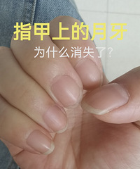 为什么指甲上的月牙消失了?坚持这样做,完全是可以恢复的