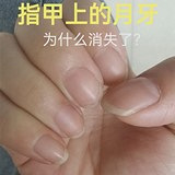 指甲上的月牙消失了?