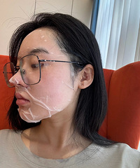 我宣布超声炮将列入我的人生清单,瘦脸效果真好