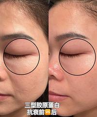 眼周抗衰其实也不难,用这个方法,眼部干纹很快就淡化了