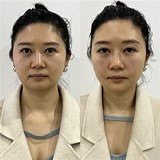这方法真能悄悄变年轻