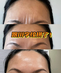 ͷϵĴƣʵܼ򵥣ֻҪٿ͸㶨