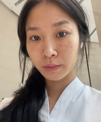 油痘肌尝试了水光,恢复几天之后,脸确实变得透亮了