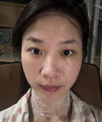 油痘肌尝试水光,恢复几天后,脸确实变得透亮了