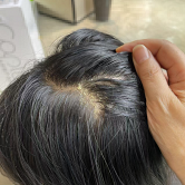 孩子的头发又稀又油