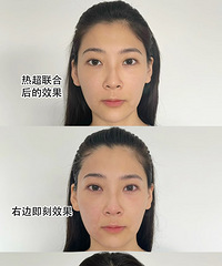 30+õĸ߶˿˥֣ұ˺ܶ