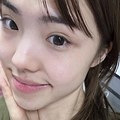 敏感肌的红血丝都淡了