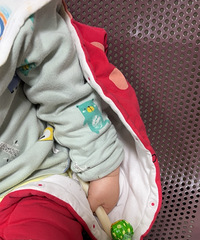 小宝宝手臂莫名脱臼