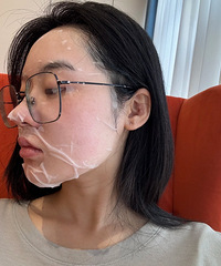 神器超声炮,没想象中痛,比想象中好