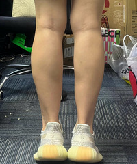 瘦小腿还是只有靠这个方法,尝试之后细了好多!还能维持2年多
