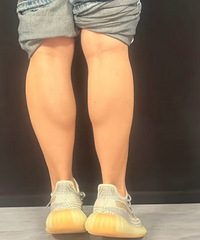瘦小腿还是只有靠这个方法,尝试之后细了好多!还能维持2年多
