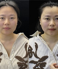 方圆脸找到了变小脸的好方法