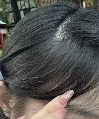 突然长了好多白头发,到底是怎么回事?有人跟我一样吗