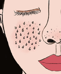 ˵˵ʲôҽĿë׵ģöƼˮ