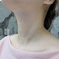 颈纹真的能淡化掉呀