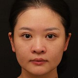 做了美白水光真变白了