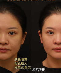 真的能从黑皮变成白皮吗?尝试了这个方法,真的有用
