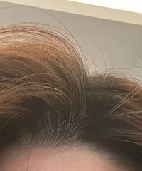 get一个发根油得超慢的方法!适合细软塌得姐妹们