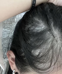 ѷӦô˵ҪԺɫʳڷ