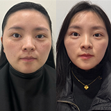 真能让脸变小一大圈