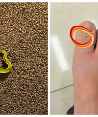 重庆近期高发!不!要!用!嘴!吸