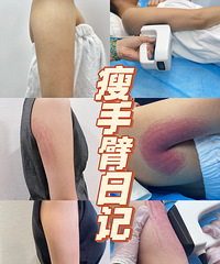 夏天到了!用这个方法一周后,就能让臂围小一圈