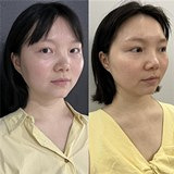 提升紧致面部的好方法