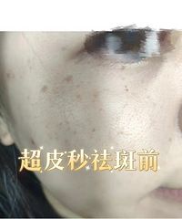 û뵽ô򵥣3γƤ㶨ȸ