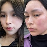黑眼圈眼袋都能消失掉