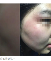 17��Ů������ͬѧ����­�����ˣ�У����Ӧ