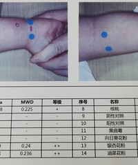 好气人,喝奶当喝水的娃竟然牛奶过敏
