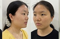 欧洲之星也能美白紧致皮肤,夏天试试这个方法