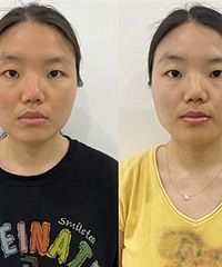 这是个夏天也适用的美白紧致法