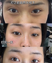 [����]�ṵ+��΢�۴�+����Ȧ������780Ԫ�ͽ������Щ����