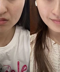 [����]5�����꼪��̫�����ˣ���һ�ξ���ӵ��һ��Ŀ�˥Ч��