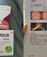 时隔四年,又去做了无痛胃镜