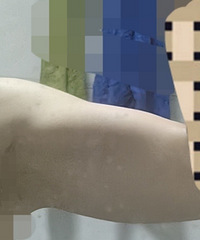 ͻȻ�����ֱ۱�����������